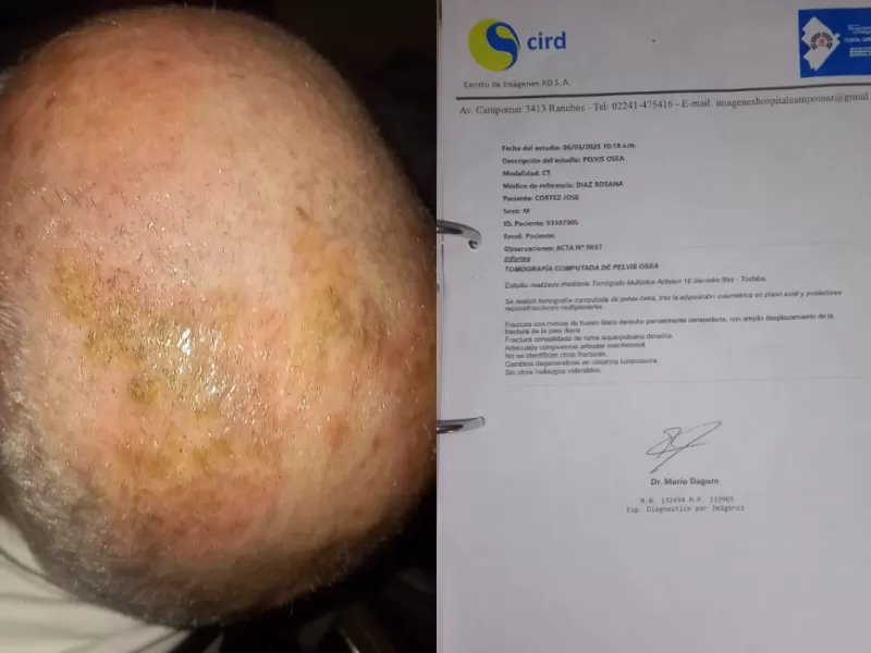 General Paz: denuncian trabas para investigar muertes en el Hospital Campomar