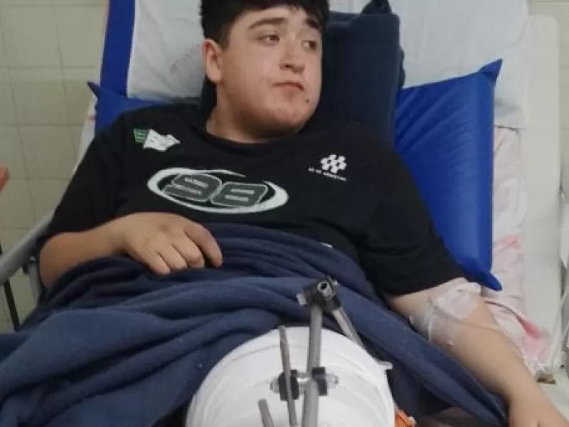 Anton sufrió un accidente en moto y necesita una costosa operación para recuperar su pierna