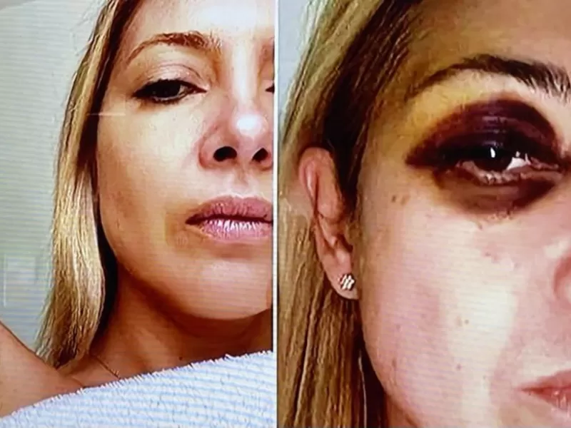 Salieron a la luz fotos de Fabiola Yañez golpeada por Alberto Fernández
