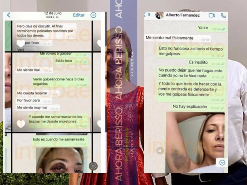 Salieron a la luz fotos de Fabiola Yañez golpeada por Alberto Fernández