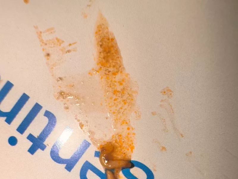 Indignación en Ensenada: encontraron gusanos en la comida del Hospital Cestino