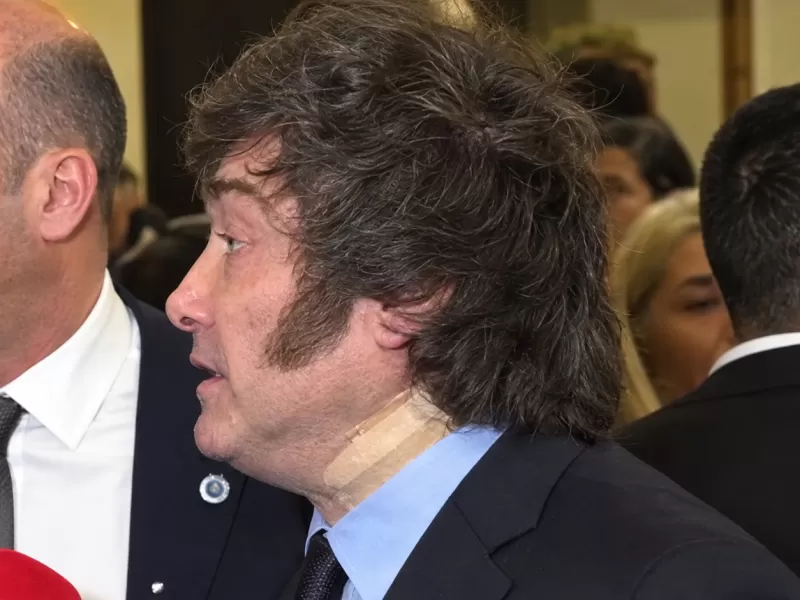 Un accidente al salir de la ba&ntilde;era en Madrid: la explicaci&oacute;n oficial sobre el vendaje de Javier Milei en Espa&ntilde;a