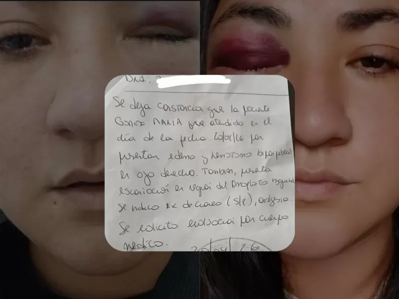 Denunci&oacute; una violenta agresi&oacute;n de su expareja y cuestion&oacute; la respuesta judicial