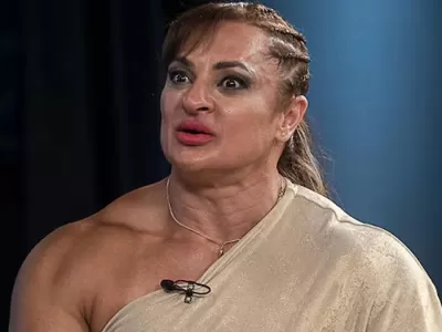 La operación estética que complicó el cuadro de “Locomotora” Oliveras antes del ACV