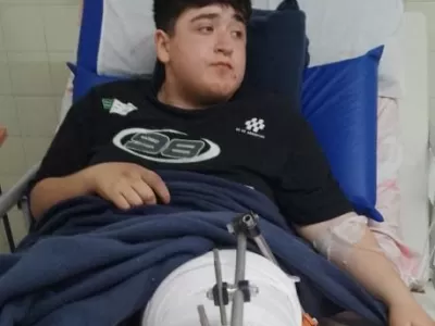 Anton sufrió un accidente en moto y necesita una costosa operación para recuperar su pierna
