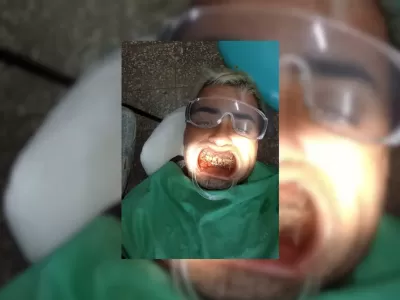 Brutalidad: volv&iacute;a de Berisso tras jugar al f&uacute;tbol, lo confundieron con un motochorro y le fracturaron el rostro con la culata de una pistola