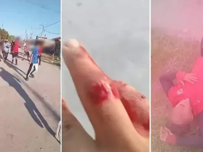 Violencia en la Liga Amistad: graves incidentes en un partido entre Berisso y Ensenada