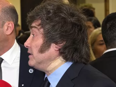 Un accidente al salir de la ba&ntilde;era en Madrid: la explicaci&oacute;n oficial sobre el vendaje de Javier Milei en Espa&ntilde;a
