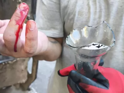 Preocupaci&oacute;n por un nuevo recolector municipal herido al manipular residuos